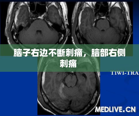 布被瓦器 第2页
