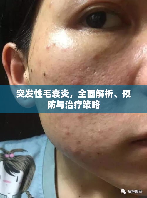 突发性毛囊炎，全面解析、预防与治疗策略