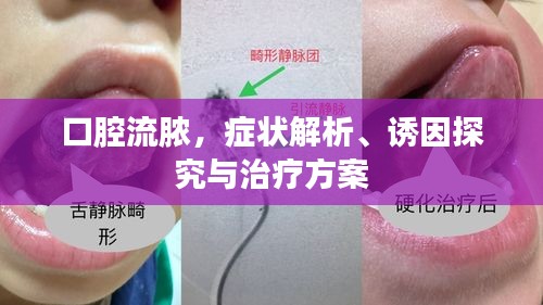 口腔流脓，症状解析、诱因探究与治疗方案