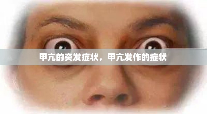甲亢的突发症状，甲亢发作的症状 